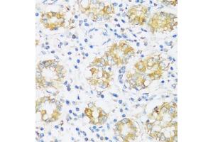 Immunohistochemistry of paraffin-embedded human stomach using BRSK1 antibody  at dilution of 1:100 (40x lens).