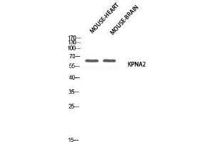 Western Blot (WB) analysis of Mouse Heart Mouse Brain using KPNA2 antibody. (KPNA2 anticorps)