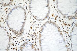 anti-H3 Histone, Family 3A (H3F3A) antibody