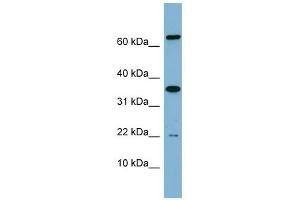 RWDD1 antibody used at 1 ug/ml to detect target protein. (RWDD1 anticorps  (Middle Region))