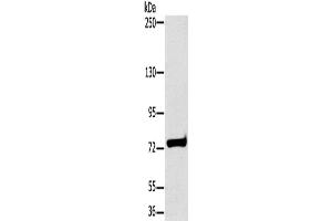 Western Blotting (WB) image for anti-Hydroxysteroid (17-Beta) Dehydrogenase 4 (HSD17B4) antibody (ABIN2430254) (HSD17B4 anticorps)