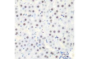 Immunohistochemistry of paraffin-embedded rat liver using CASP9 antibody at dilution of 1:100 (40x lens). (Caspase 9 anticorps)