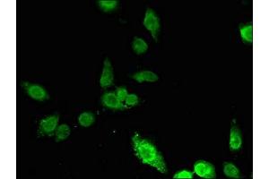 Immunofluorescent analysis of Hela cells using ABIN7156257 at dilution of 1:100 and Alexa Fluor 488-congugated AffiniPure Goat Anti-Rabbit IgG(H+L)