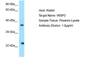 Host: Rabbit  Target Name: WISP2  Antibody Dilution: 1. (WISP2 anticorps  (C-Term))