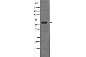 Western blot analysis of extracts from HT-29 cells using GABRD antibody.