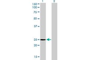 Western Blot analysis of THAP1 expression in transfected 293T cell line by THAP1 monoclonal antibody (M01), clone 2C1-2F2.