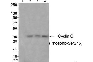 Western blot analysis of extracts from 3T3 cells (Lane 2), A549 cells (Lane 3) and Hela cells (Lane 4), using Cyclin C (Phospho-Ser275) Antibody. (Cyclin C anticorps  (pSer275))