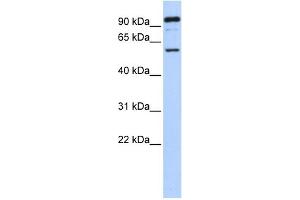 WB Suggested Anti-GABRR1 Antibody Titration:  0. (GABRR1 anticorps  (N-Term))