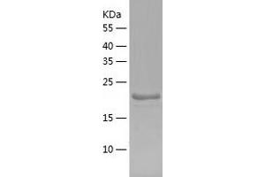 Western Blotting (WB) image for SSU72 RNA Polymerase II CTD Phosphatase Homolog (SSU72) (AA 1-194) protein (His-IF2DI Tag) (ABIN7125202)