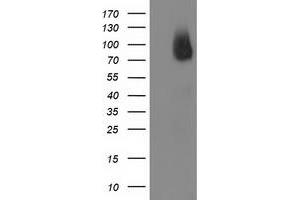 Western Blotting (WB) image for anti-Breast Cancer Anti-Estrogen Resistance 1 (BCAR1) antibody (ABIN1496834)