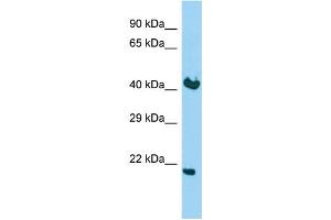 Host: Rabbit Target Name: KDELR2 Sample Type: Fetal Brain lysates Antibody Dilution: 1. (KDELR2 anticorps  (C-Term))