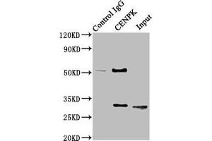 Immunoprecipitating CENPK in Hela whole cell lysate Lane 1: Rabbit control IgG instead of ABIN7147366 in Hela whole cell lysate. (CENPK anticorps  (AA 1-269))