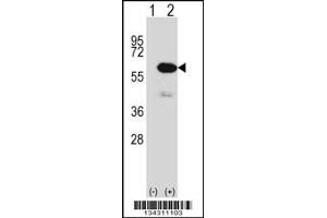 Western blot analysis of METAP2 using rabbit polyclonal METAP2 Antibody using 293 cell lysates (2 ug/lane) either nontransfected (Lane 1) or transiently transfected (Lane 2) with the METAP2 gene. (METAP2 anticorps  (N-Term))