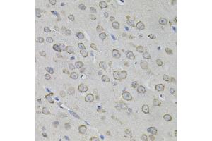 Immunohistochemistry of paraffin-embedded mouse brain using MYO10 antibody. (Myosin X anticorps)
