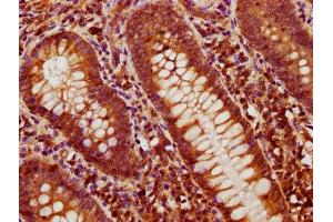 anti-Bone Morphogenetic Protein 4 (BMP4) (AA 303-408) antibody