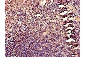 Immunohistochemistry of paraffin-embedded human tonsil tissue using ABIN7158660 at dilution of 1:100 (HELLS anticorps  (AA 550-600))