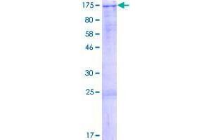 Image no. 1 for Zinc Finger Protein 828 (ZNF828) (AA 1-812) protein (GST tag) (ABIN1326457)