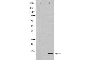 Western blot analysis of extracts from COS7 cells, treated with TSA 400nM 24h, using Acetyl-Histone H4 (Lys12) Antibody.