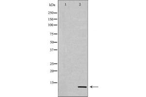 Western blot analysis of extracts from COS7 cells, treated with TSA 400nM 24h, using Acetyl-Histone H4 (Lys12) Antibody. (Histone H4 anticorps  (acLys12))