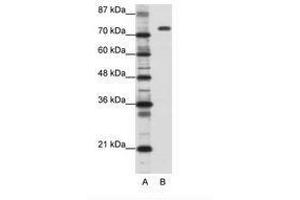 Image no. 1 for anti-Nucleolin (NCL) (C-Term) antibody (ABIN202879) (Nucleolin anticorps  (C-Term))