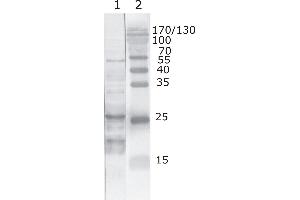 Western Blot testing of HIV-1 recombinant Tat protein. (HIV-1 Tat anticorps  (AA 6-12))