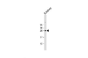 Western Blot at 1:2000 dilution + Rat kidney lysate Lysates/proteins at 20 ug per lane.