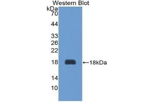 Detection of Recombinant AGRP, Rat using Polyclonal Antibody to Agouti Related Protein (AGRP) (AGRP anticorps  (AA 34-127))