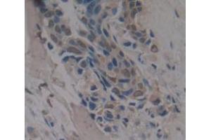 Figure. (RBM20 anticorps  (AA 1089-1227))