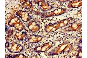 Immunohistochemistry of paraffin-embedded human small intestine tissue using ABIN7154264 at dilution of 1:100