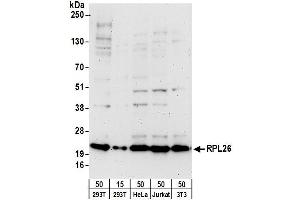 anti-Ribosomal Protein L26 (RPL26) (AA 95-145) antibody