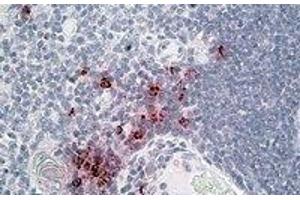 Immunohistochemistry (IHC) image for anti-DEFA1/3 (Internal Region) antibody (ABIN2464584) (DEFA1/3 (Internal Region) anticorps)