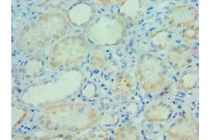 Immunohistochemistry of paraffin-embedded human kidney tissue using ABIN7163755 at dilution of 1:100 (PARP3 anticorps  (AA 294-533))