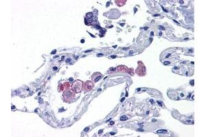 Human Lung: Formalin-Fixed, Paraffin-Embedded (FFPE)