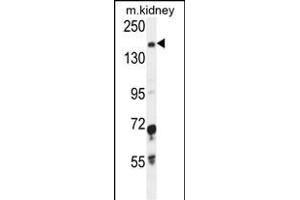 IGSF1 Antibody (C-term) (ABIN654689 and ABIN2844381) western blot analysis in mouse kidney tissue lysates (35 μg/lane). (IGSF1 anticorps  (C-Term))