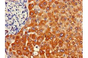 Immunohistochemistry of paraffin-embedded human liver tissue using ABIN7144675 at dilution of 1:100 (NAT1 anticorps  (AA 1-288))