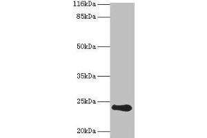 Western blot All lanes: RCVRN antibody at 2 μg/mL + Mouse eye tissue Secondary Goat polyclonal to rabbit IgG at 1/10000 dilution Predicted band size: 24 kDa Observed band size: 24 kDa