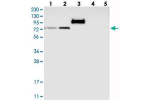 Western blot analysis of Lane 1: RT-4, Lane 2: U-251 MG, Lane 3: Human Plasma, Lane 4: Liver, Lane 5: Tonsil with GARNL4 polyclonal antibody  at 1:250-1:500 dilution. (RAP1GAP2 anticorps)