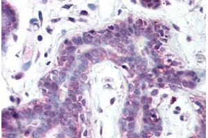 anti-Protein Arginine Methyltransferase 6 (PRMT6) (AA 23-43) antibody