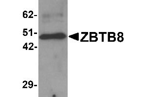 Western Blotting (WB) image for anti-Zinc Finger and BTB Domain Containing 8A (ZBTB8A) (C-Term) antibody (ABIN1030814)