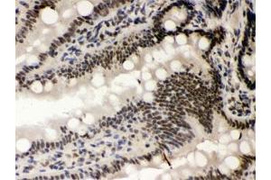 IHC testing of FFPE rat intestine with CSNK1A1 antibody. (CSNK1A1 anticorps)