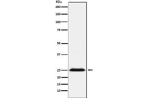 Western blot analysis of BAP31 expression in NCCIT cell lysate.