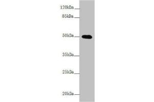 Western blot All lanes: L2HGDH antibody at 4. (L2HGDH anticorps  (AA 1-220))