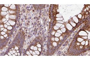 ABIN6272937 at 1/100 staining Mouse colon tissue by IHC-P. (BBS2 anticorps  (C-Term))