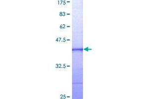 Image no. 1 for Budding Uninhibited By Benzimidazoles 1 Homolog (Yeast) (BUB1) (AA 1-130) protein (GST tag) (ABIN1346983)