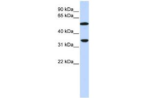 WB Suggested Anti-C4B Antibody Titration:  0. (C4B anticorps  (N-Term))