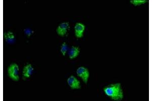 Immunofluorescence staining of Hela cells with ABIN7166241 at 1:100, counter-stained with DAPI. (UNC13B anticorps  (AA 12-215))