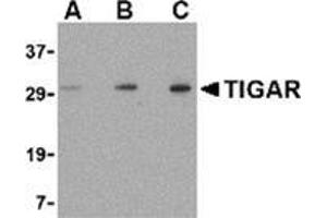 Western blot analysis of TIGAR in EL4 cell lysate with this product at (A) 0. (TIGAR anticorps  (Center))