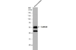 WB Image CaMK2D antibody detects CaMK2D protein by western blot analysis. (CAMK2D anticorps)