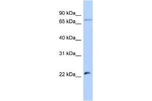 anti-Heat Shock Transcription Factor, Y Linked 2 (HSFY2) (Middle Region) antibody