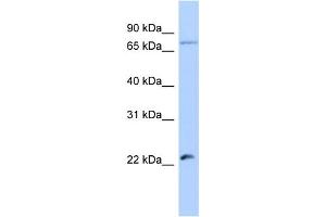 Host:  Rabbit  Target Name:  HSFY2  Sample Type:  Jurkat Whole Cell lysates  Antibody Dilution:  1. (HSFY2 anticorps  (Middle Region))